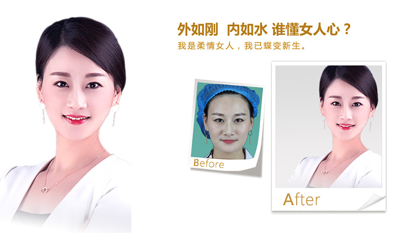 廊坊V脸、线雕隆鼻